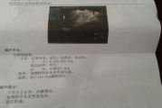 女人最多能承受多少次流产-健康与风险解析
