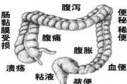 头疼恶心想吐：揭秘身体发出的警告信号