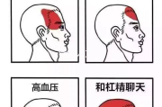 头疼吃什么药有效？2025年最新指南告诉你！