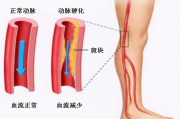 下肢腿部抬高垫,s腿垫翻身垫使用指南-改善体态与血液循环的辅助工具