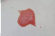 宝宝身上小红疹的成因与应对策略-家长必读指南