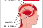 头疼如何有效缓解？2025年最新攻略一览