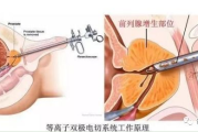 性生活后尿道疼痛小便刺痛的原因与对策-健康生活指南