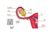 女性健康，全方位关爱与呵护